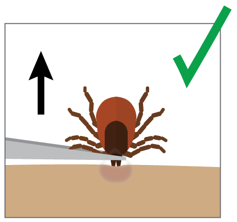 Tick Removal