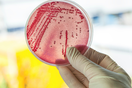 Petri Dish with Bacteria