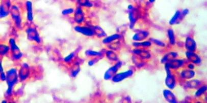 Gram Stain Clostridium botulinum