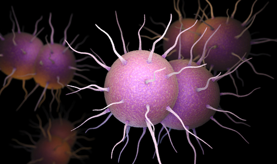 What does gonorrhea look like What does gonorrhea look like
