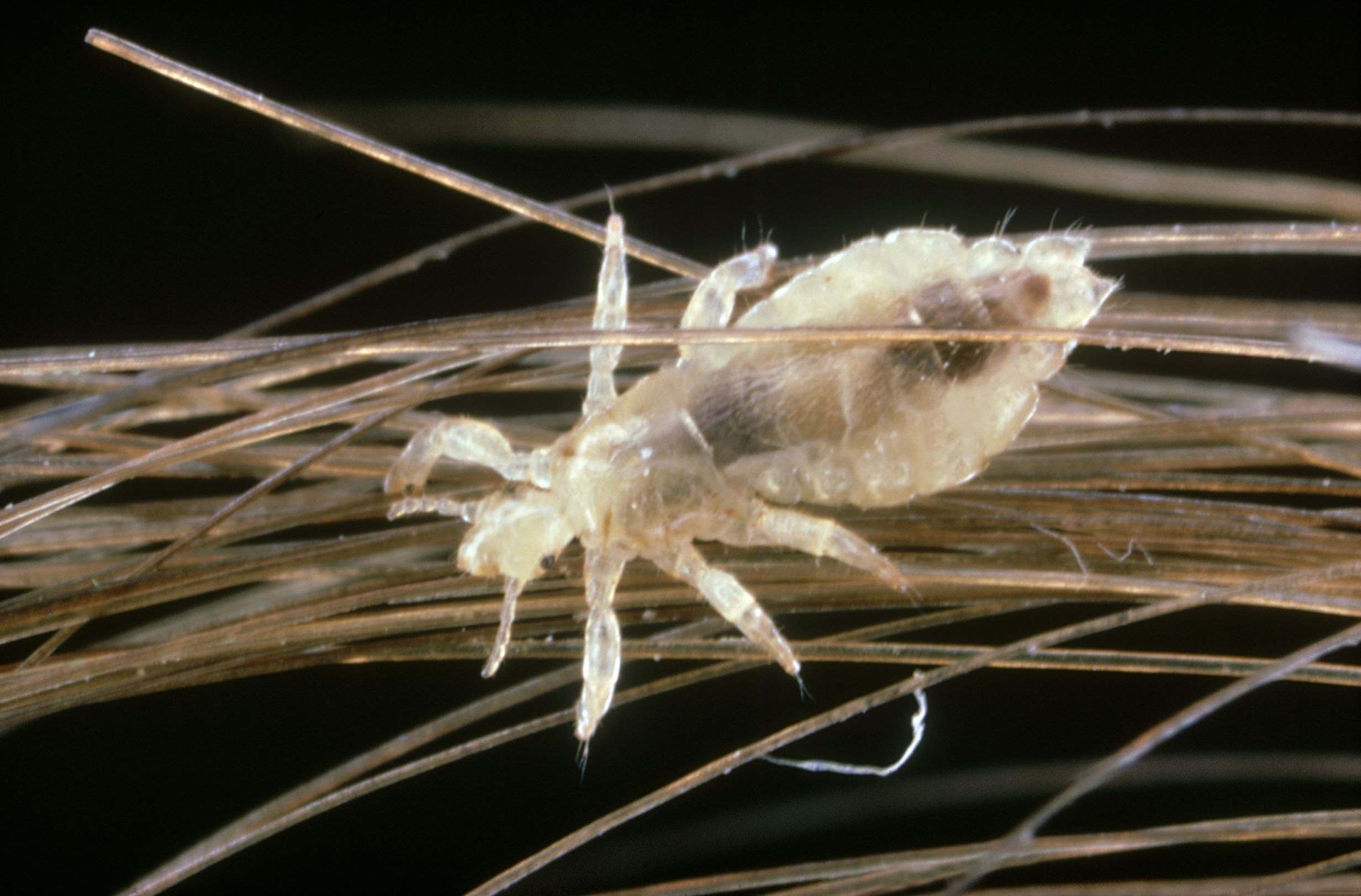 Head Body and Pubic Lice Causes Treatment and Prevention