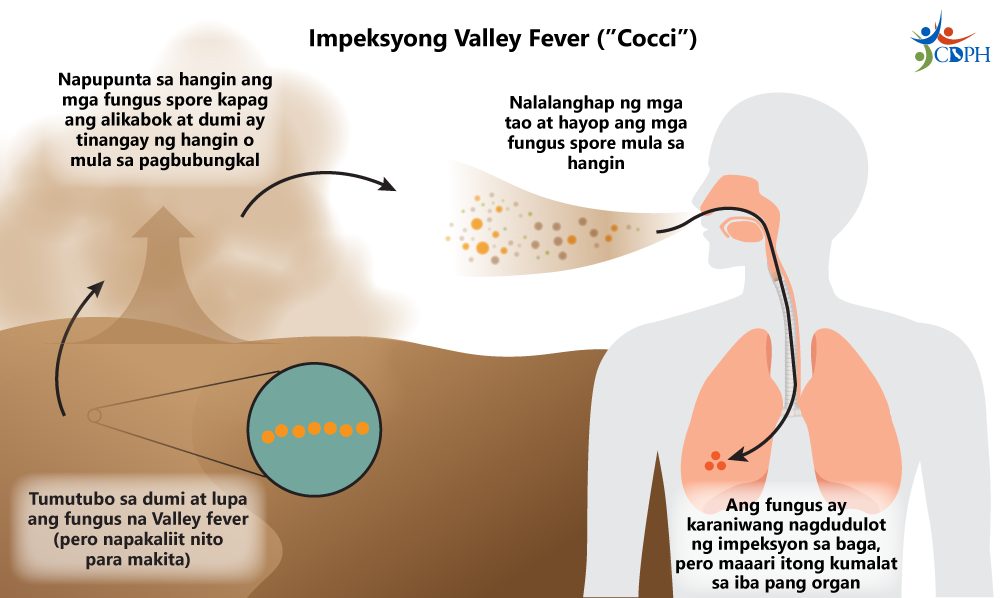 Impeksyong Valley Fever (Cocci)