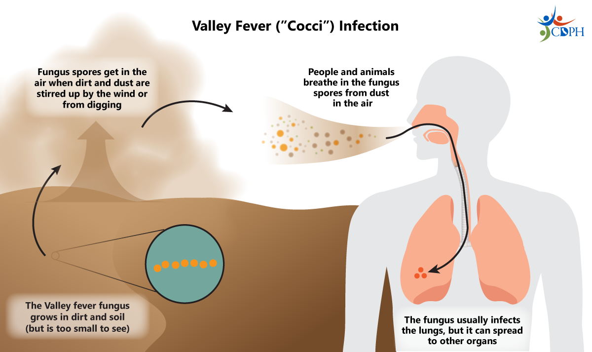 Valley fever ("cocci") infection. The Valley fever fungus grows in the dirt. Spores get into the air when dust is stirred up.