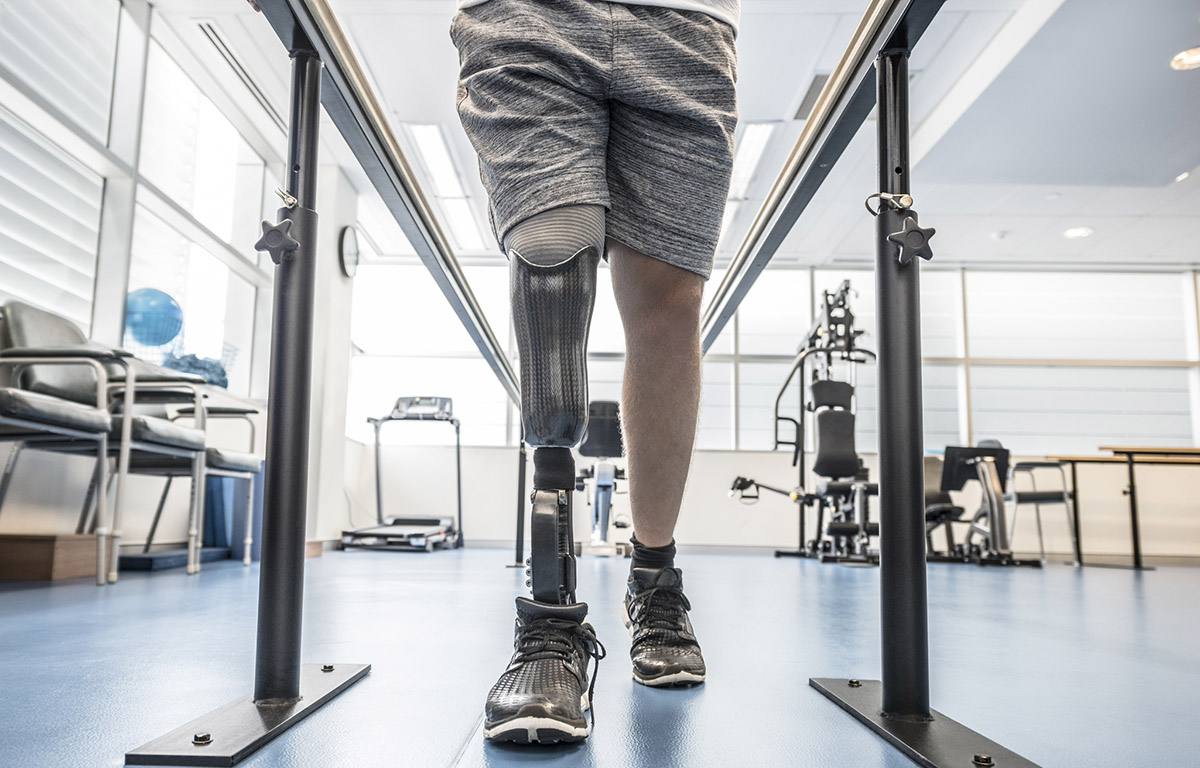 Man with prosthetic leg learning to walk
