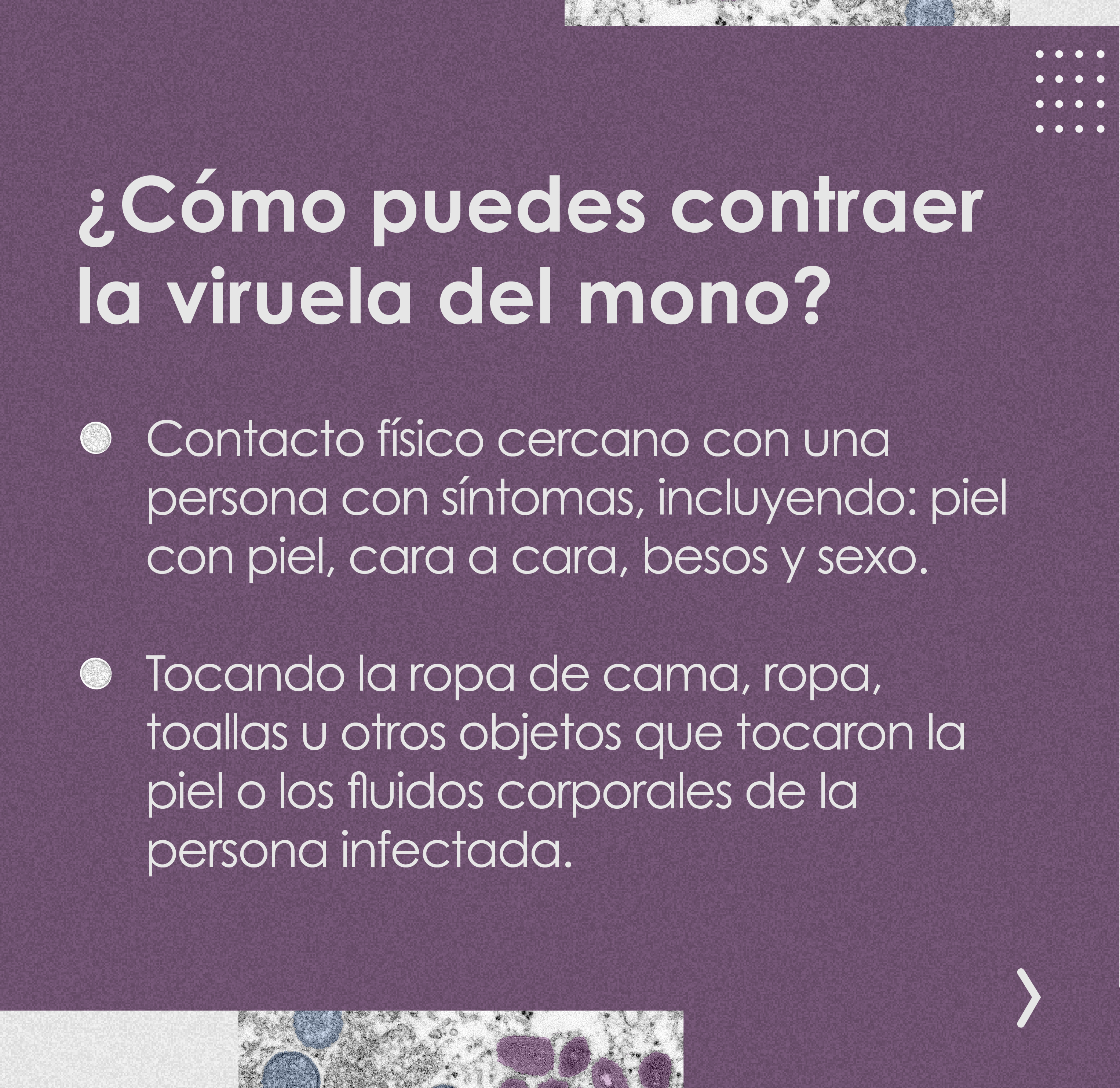 Signos/síntomas, transmisión y prevención de la viruela del mono