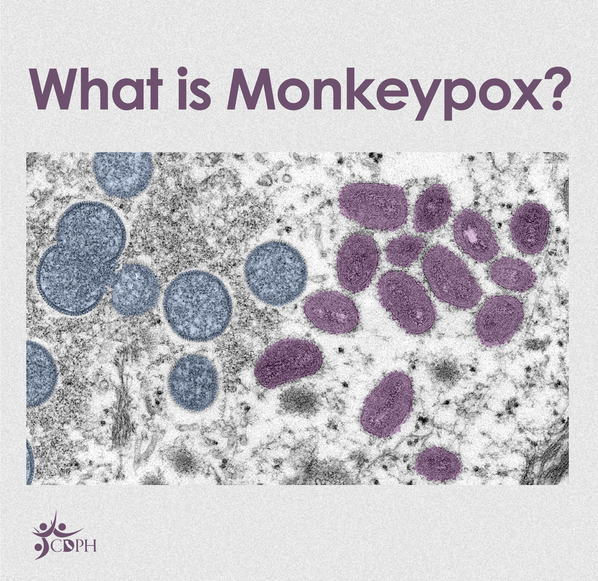 Whati s Monkeypox
