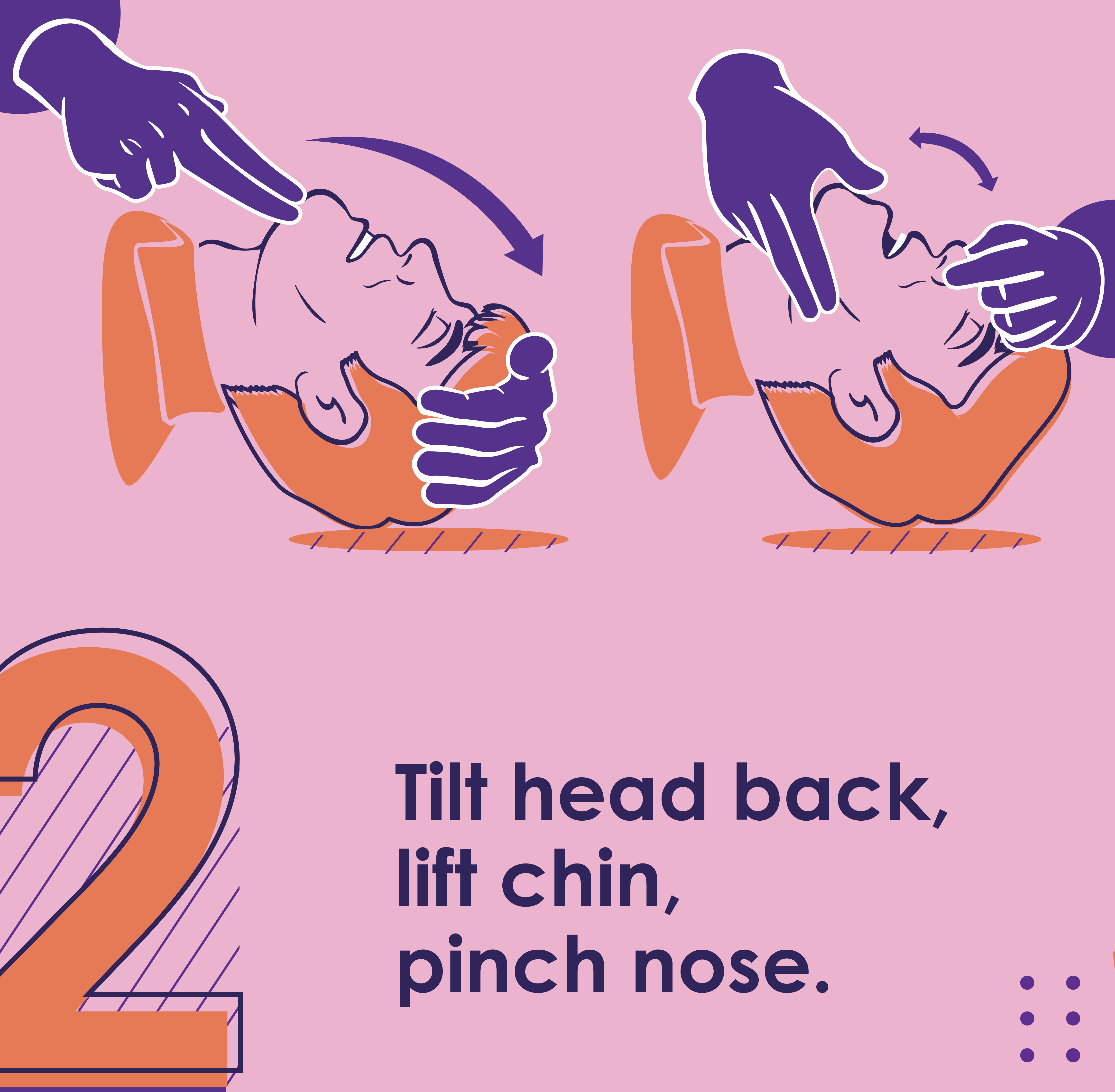 Tilt head back, lift chin, pinch nose.