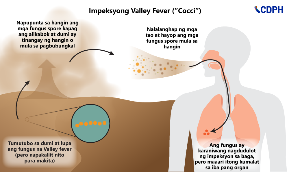 VF-Transmission-Cycle_tgl Impeksyong Valley Fever (Cocci)