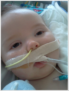 Patient with Infant Botulism Patient with Infant Botulism